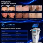 DerRF™ 4 w 1 System Mikroigłowy