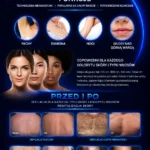 Profesjonalny czterozwiązkowy laser do depilacji