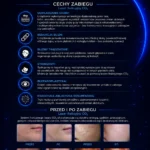 Przenośny Laser Frakcyjny CO₂ LUMEDRA