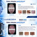 Analizator Skin PRO