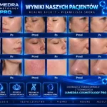 Lumedra Cosmetology PRO 17 w 1